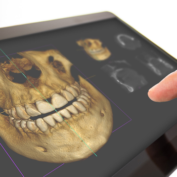 3D 齒雕設備,當日完成全瓷冠